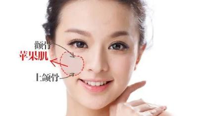 蘋果肌好看還是不好看？女生有蘋果肌好看嗎？
