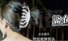 鯊魚夾是有危害的!女子頭戴鯊魚夾摔倒后成植物人