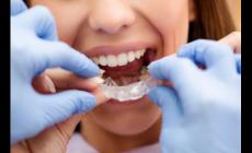 牙齒矯正的費用一般是多少 牙齒矯正大概的費用是多少